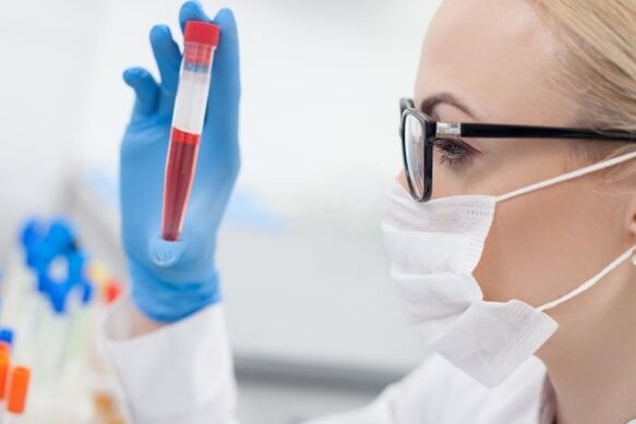 Hipertansiyon için kan testi